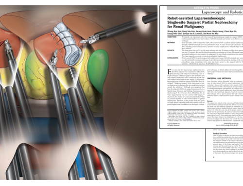 MID Medical Illustration – Urology  –  Laparoscopy and Robotics