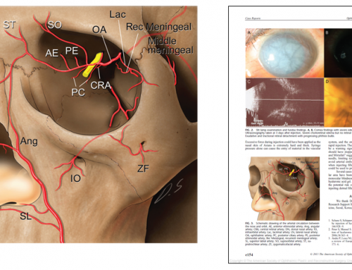 MID Medical Illustration – 2011 The American Society of Ophthalmic Plastic and Reconstructive Surgery, Inc.