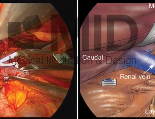 Video Atlas of Advanced Minimally Invasive Surgery